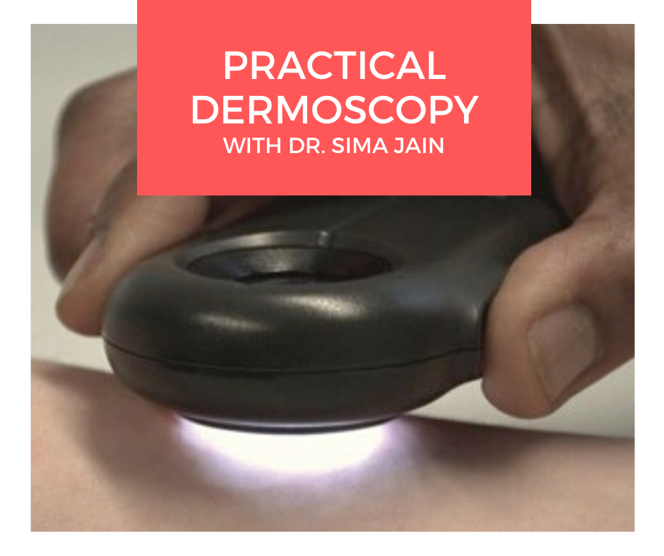 Dermoscopy tool image