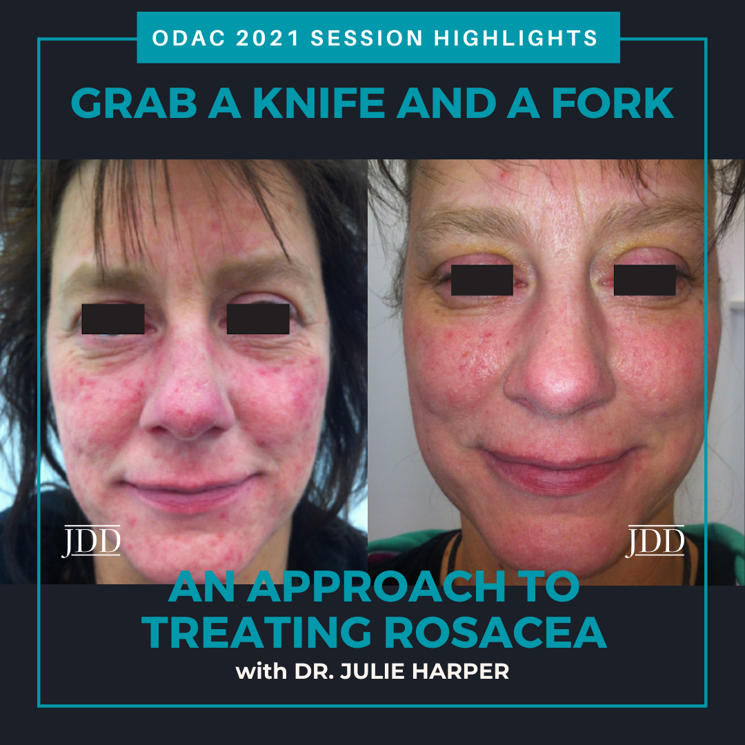 ODAC Dermatology Conference Highlights Rosacea